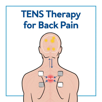 A graphic of a man with electrodes on his back. Text, "TENS Therapy for Back Pain"
