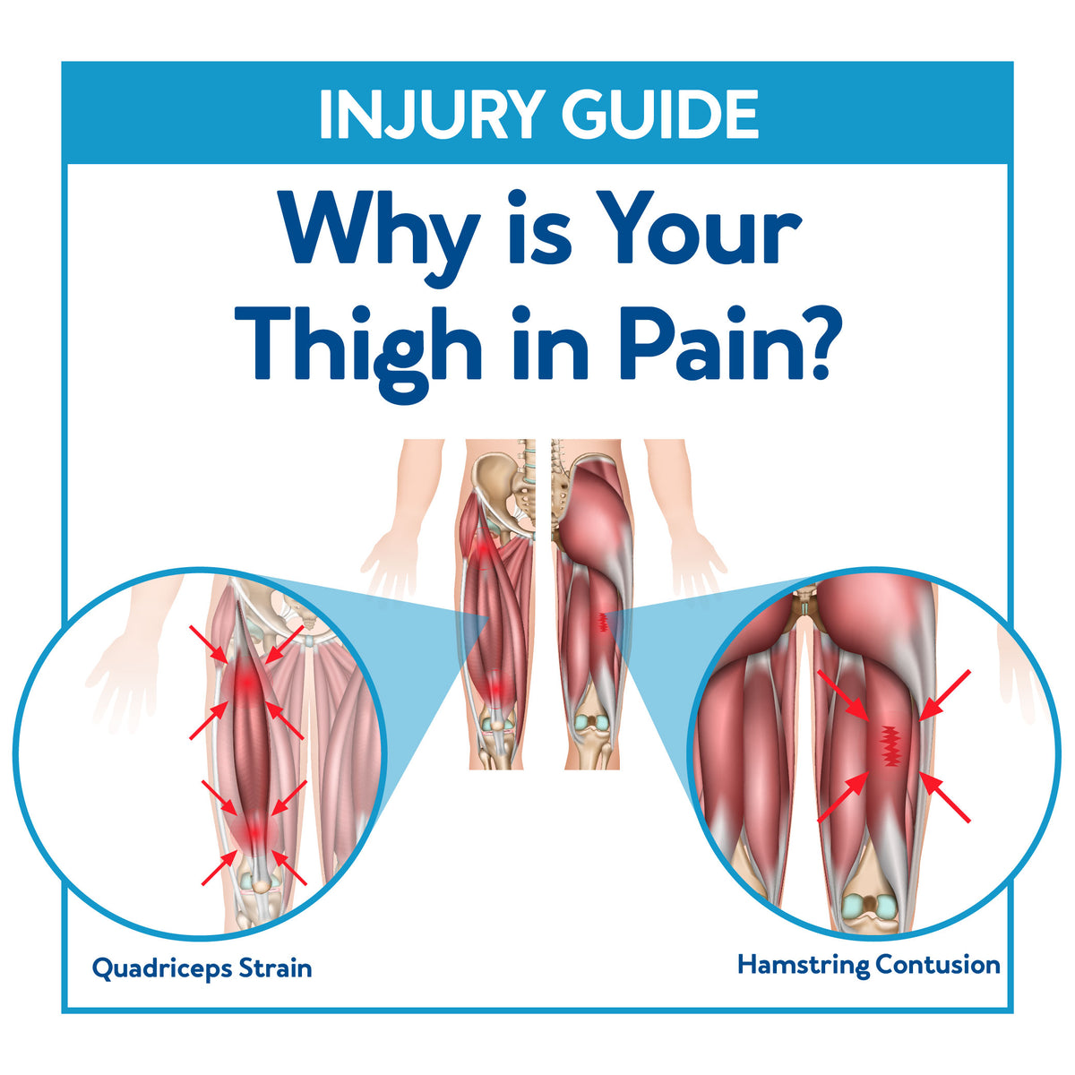 Blog  Lower Leg Pain: Causes and Treatments