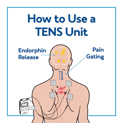 A graphic of a person using a TENS unit. Text, "How to Use a TENS Unit"